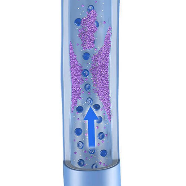 Darstellung der Anatomie der Vene bei einer vorhandenen Venenthrombose. Ein verlangsamter Blutfluss, Wandveränderungen und Gerinnungsstörungen verursachen ein erhöhtes Risiko zur Thrombosebildung.